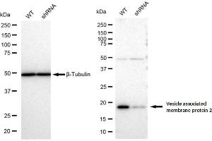 Western blotting analysis using Vesicle associated membrane protein 2 antibody (ABIN7800830). (Rekombinanter VAMP2 Antikörper)