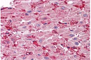 Human Heart (formalin-fixed, paraffin-embedded) stained with SCO1 antibody ABIN214471 at 2. (SCO1 Antikörper  (Internal Region))