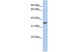 Western Blotting (WB) image for anti-Hydroxyacyl-CoA Dehydrogenase (HADH) antibody (ABIN2459806) (HADH Antikörper)