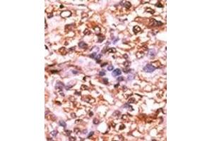Image no. 2 for anti-Retinoblastoma 1 (RB1) (pSer788) antibody (ABIN358214) (Retinoblastoma 1 Antikörper  (pSer788))