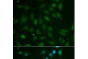 Immunofluorescence analysis of MCF-7 cells using ABO Polyclonal Antibody (ABO Antikörper)