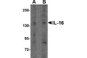 Western Blotting (WB) image for anti-Interleukin 16 (IL16) (N-Term) antibody (ABIN1031408) (IL16 Antikörper  (N-Term))