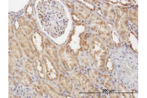 Immunoperoxidase of monoclonal antibody to CFLAR on formalin-fixed paraffin-embedded human kidney.
