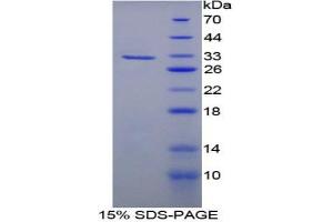 SDS-PAGE analysis of Rat Fatty Acid Synthase Protein.