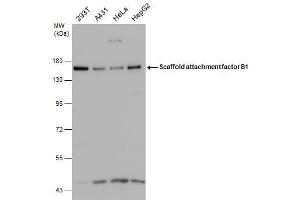 WB Image Various whole cell extracts (30 μg) were separated by 7. (SAFB Antikörper)
