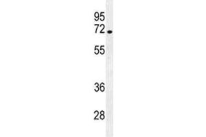 NUMB antibody western blot analysis in NCI-H292 lysate. (NUMB Antikörper  (AA 1-30))