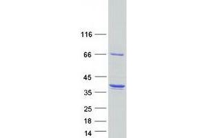 Western Blotting (WB) image for Dynein, Axonemal, Light Intermediate Chain 1 (DNALI1) protein (Myc-DYKDDDDK Tag) (ABIN2719612)