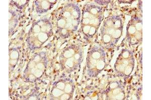 Immunohistochemistry of paraffin-embedded human colon tissue using ABIN7158817 at dilution of 1:100 (LYG1 Antikörper  (AA 20-194))