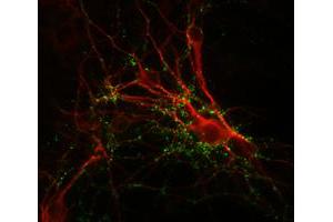 Immunochemical staining of cultured caudate neurons with SYN1 polyclonal antibody  (green) and anti-MAP antibody (red). (SYN1 Antikörper)