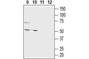 Western blot analysis of mouse colon (lanes 9 and 11) and human colorectal adenocarcinoma (Colo 205) cell line (lanes 10 and 12) lysates:9,10. (omega-3 Fatty Acid Receptor 1 (O3FAR1) Peptid)