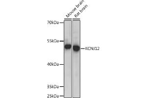 Western blot analysis of extracts of various cell lines, using KCNJ12 Rabbit pAb (ABIN7269472) at 1:300 dilution. (Kir2.2 Antikörper  (AA 354-433))