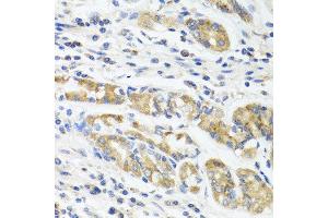 Immunohistochemistry of paraffin-embedded human stomach using IL11 antibody at dilution of 1:100 (40x lens). (IL-11 Antikörper)