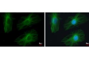 ICC/IF Image TUBB2A antibody detects TUBB2A protein at cytoskeleton by immunofluorescent analysis. (TUBB2A Antikörper)