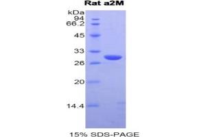 SDS-PAGE (SDS) image for alpha-2-Macroglobulin (A2M) ELISA Kit (ABIN6574246)