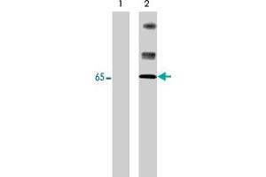 Western blot analysis of control (lane 1) and pervanadate-treated (lane 2) A-431 cells (20 ug/lane). (Neural Wiskott-Aldrich syndrome protein (WASL) (pTyr256) Antikörper)