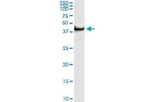 Immunoprecipitation of TWF1 transfected lysate using mouse monoclonal anti-TWF1 and Protein A Magnetic Bead (TWF1 (Human) IP-WB Antibody Pair)