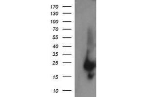 Image no. 1 for anti-RAB37, Member RAS Oncogene Family (RAB37) antibody (ABIN1500562) (RAB37 Antikörper)
