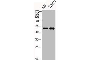 Western Blot analysis of KB 22RV1 cells using Phospho-KOR-1 (S369) Polyclonal Antibody (OPRK1 Antikörper  (pSer369))