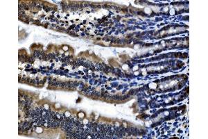 IHC analysis of CDC27 using anti-CDC27 antibody (ABIN7602163). (CDC27 Antikörper  (AA 609-824))