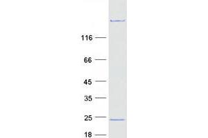 Western Blotting (WB) image for Myosin, Light Chain 12A, Regulatory, Non-Sarcomeric (MYL12A) protein (Myc-DYKDDDDK Tag) (ABIN2726661)