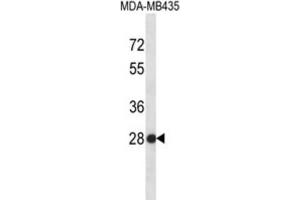 Western Blotting (WB) image for anti-Small Nuclear Ribonucleoprotein Polypeptide B (SNRPB2) antibody (ABIN2996703) (SNRPB2 Antikörper)