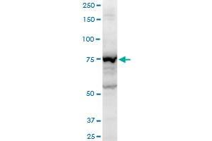 AMOT polyclonal antibody (A01), Lot # 060613JCS1.
