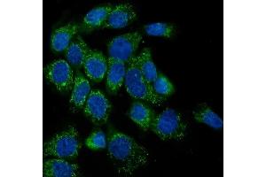 IF analysis of LPP using anti-LPP antibody (ABIN7599606). (LPP Antikörper  (AA 10-572))