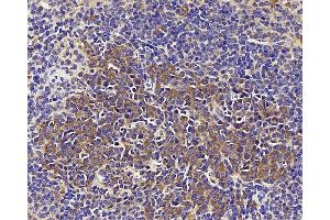 Immunohistochemistry analysis of paraffin-embedded mouse spleen using CD284 Polyclonal Antibody at dilution of 1:1000. (TLR4 Antikörper)