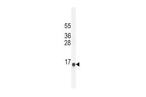 SG11A Antibody (N-term) (ABIN654791 and ABIN2844469) western blot analysis in NCI- cell line lysates (35 μg/lane). (SPAG11A Antikörper  (N-Term))