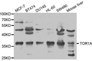 Western blot analysis of extracts of various cell lines, using TOR1A antibody. (TOR1A Antikörper)