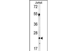 Western blot analysis of C1QA antibody in Jurkat cell line lysates (35ug/lane) (C1QA Antikörper  (C-Term))