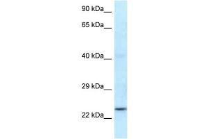 WB Suggested Anti-Rnf141 Antibody Titration: 1. (RNF141 Antikörper  (N-Term))