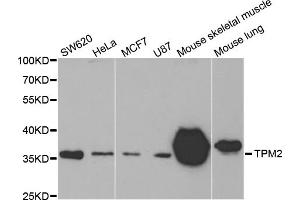 Western blot analysis of extracts of various cell lines, using TPM2 antibody. (TPM2 Antikörper)