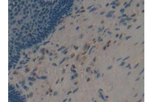IHC-P analysis of Human Esophagus Tissue, with DAB staining. (Apolipoprotein F Antikörper  (AA 122-307))