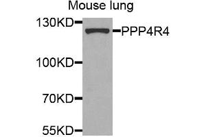 Western blot analysis of extracts of mouse lung, using PPP4R4 antibody (ABIN5974913) at 1/1000 dilution. (PPP4R4 Antikörper)