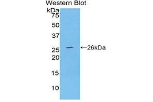 Western Blotting (WB) image for anti-Ceruloplasmin (Ferroxidase) (CP) (AA 872-1059) antibody (ABIN1077928) (Ceruloplasmin Antikörper  (AA 872-1059))