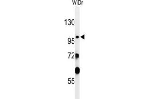 Western Blotting (WB) image for anti-Vacuolar Protein Sorting 52 Homolog (VPS52) antibody (ABIN3002120) (VPS52 Antikörper)