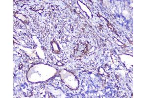 IHC analysis of INPPL1 using anti-INPPL1 antibody (ABIN6719492).