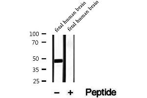 Western blot analysis of extracts of fetal human brain tissue, using Phospho-Doublecortin (Ser297) Antibody.