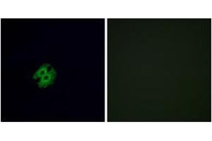 Immunofluorescence analysis of A549 cells, using OR2G2 Antibody.