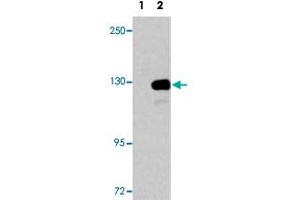 Western blot analysis of UPF1 (arrow) using UPF1 polyclonal antibody . (RENT1/UPF1 Antikörper  (AA 7-37))