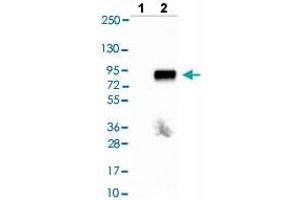 Western blot analysis of Lane 1: Negative control (vector only transfected HEK293T lysate), Lane 2: Over-expression lysate (Co-expressed with a C-terminal myc-DDK tag (~3. (Tyrosinase-Related Protein 1 Antikörper  (AA 257-377))