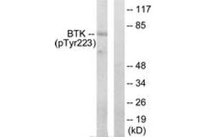 Western blot analysis of extracts from HeLa cells treated with Serum 10% 15', using BTK (Phospho-Tyr223) Antibody. (BTK Antikörper  (pTyr223))