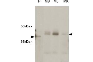 Western blot analysis The extracts of HeLa (H) cells , mouse brain (MB), mouse liver (ML) and mouse kidney (MK) tissues (each 20 ug) were resolved by SDS-PAGE, transferred to PVDF membrane and probed with anti-human RASSF1A (1:1000). (RASSF1 Antikörper  (Isoform A, N-Term))