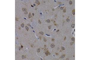 Immunohistochemistry of paraffin-embedded rat brain using POLR2L antibody (ABIN3023303, ABIN3023304, ABIN3023305 and ABIN6219564) at dilution of 1:200 (40x lens).