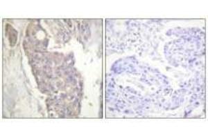 Immunohistochemistry (IHC) image for anti-TNF Receptor Superfamily, Member 6 (FAS) (C-Term) antibody (ABIN7180172)