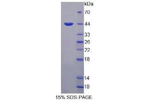 Image no. 1 for Homeodomain Interacting Protein Kinase 4 (HIPK4) (AA 288-616) protein (His tag) (ABIN6239714)