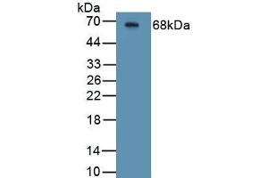 Western Blotting (WB) image for anti-Cystic Fibrosis Transmembrane Conductance Regulator (ATP-Binding Cassette Sub-Family C, Member 7) (CFTR) antibody (ABIN7434899)