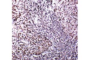 Immunohistochemistry (IHC) image for anti-V-Myb Myeloblastosis Viral Oncogene Homolog (Avian)-Like 2 (MYBL2) (AA 1-17), (N-Term) antibody (ABIN3044010)