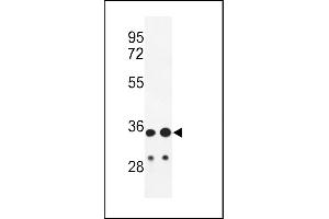 Western blot analysis of IGH Antibody (C-Term) (ABIN652729 and ABIN2837850) in HL-60,  cell line lysates (35 μg/lane). (IgH Antikörper  (C-Term))